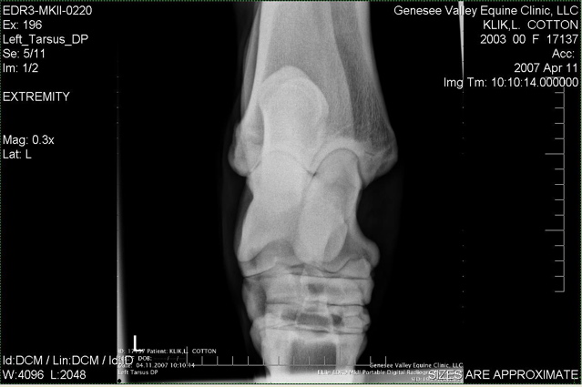 Xray_3