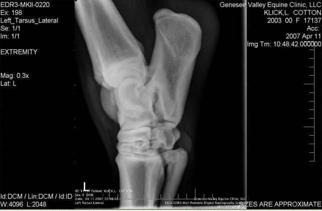 Xray_11