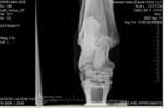 Xray_1
