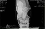 Xray_2