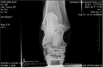 Xray_3