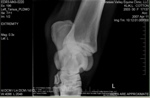 Xray_5