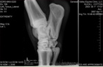 Xray_11